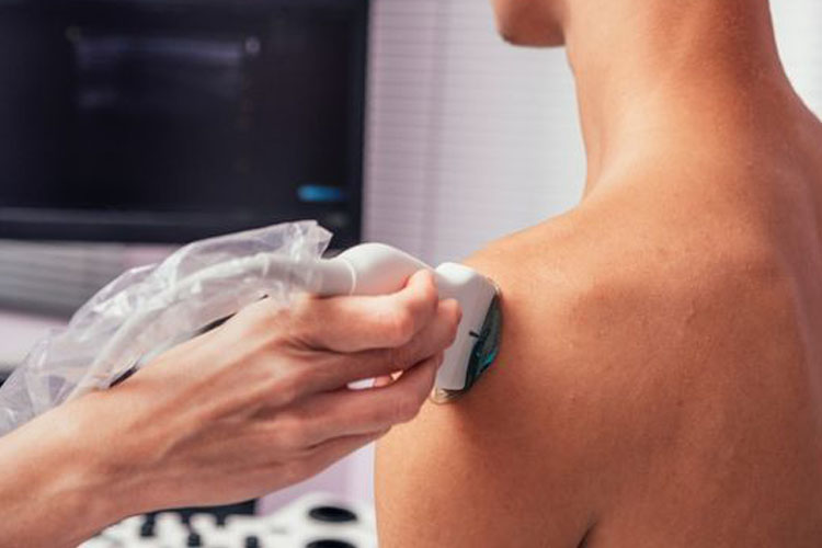 Simple muscle ultrasound may detect early prediabetes